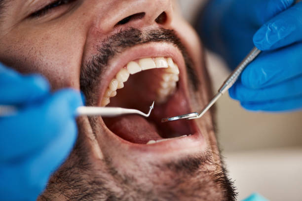 Best Dentist for Tooth Abscess  in West Little River, FL